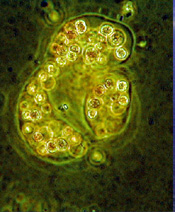 Microcystic algae